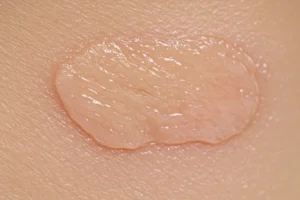 EWC Sensitive Skin Facial Waxing: 2026 Breakthroughs