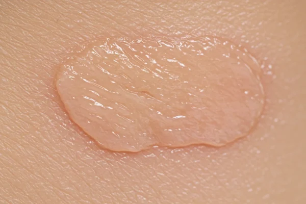 EWC Sensitive Skin Facial Waxing: 2026 Breakthroughs