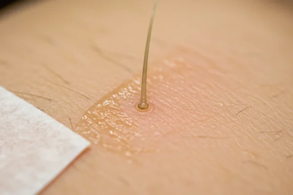 Men’s Waxing: 60% Fewer Ingrown Hairs by 2026
